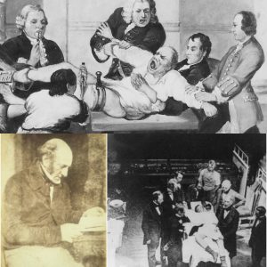 The surgery has a 300% mortality rate: In 1847, doctor Robert Liston - who is said to possess the fastest surgical speed in the world - performed surgery to amputate a patient's leg.